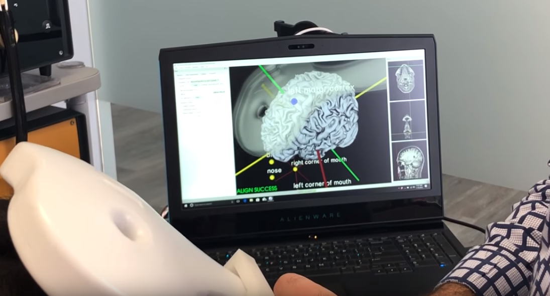 Neuronavigation Part 1