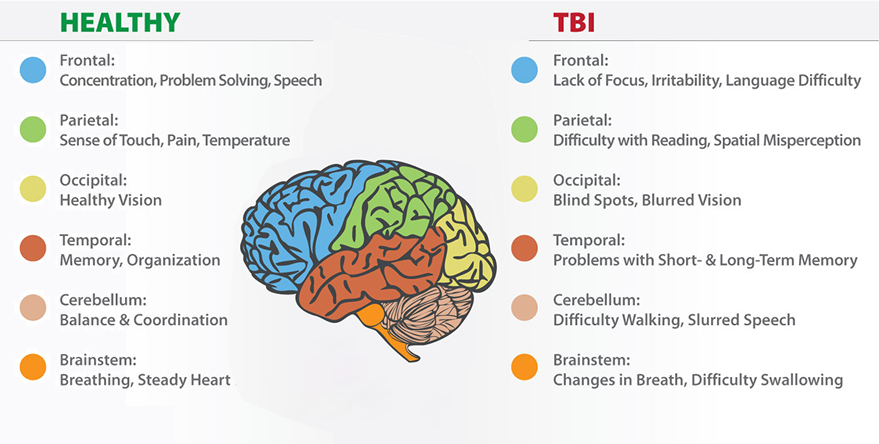 The Role of Bubbles in Brain Injury