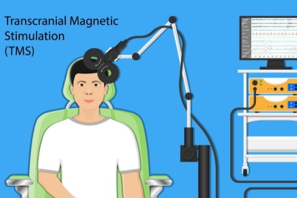 What To Know About TMS Therapy for Anxiety