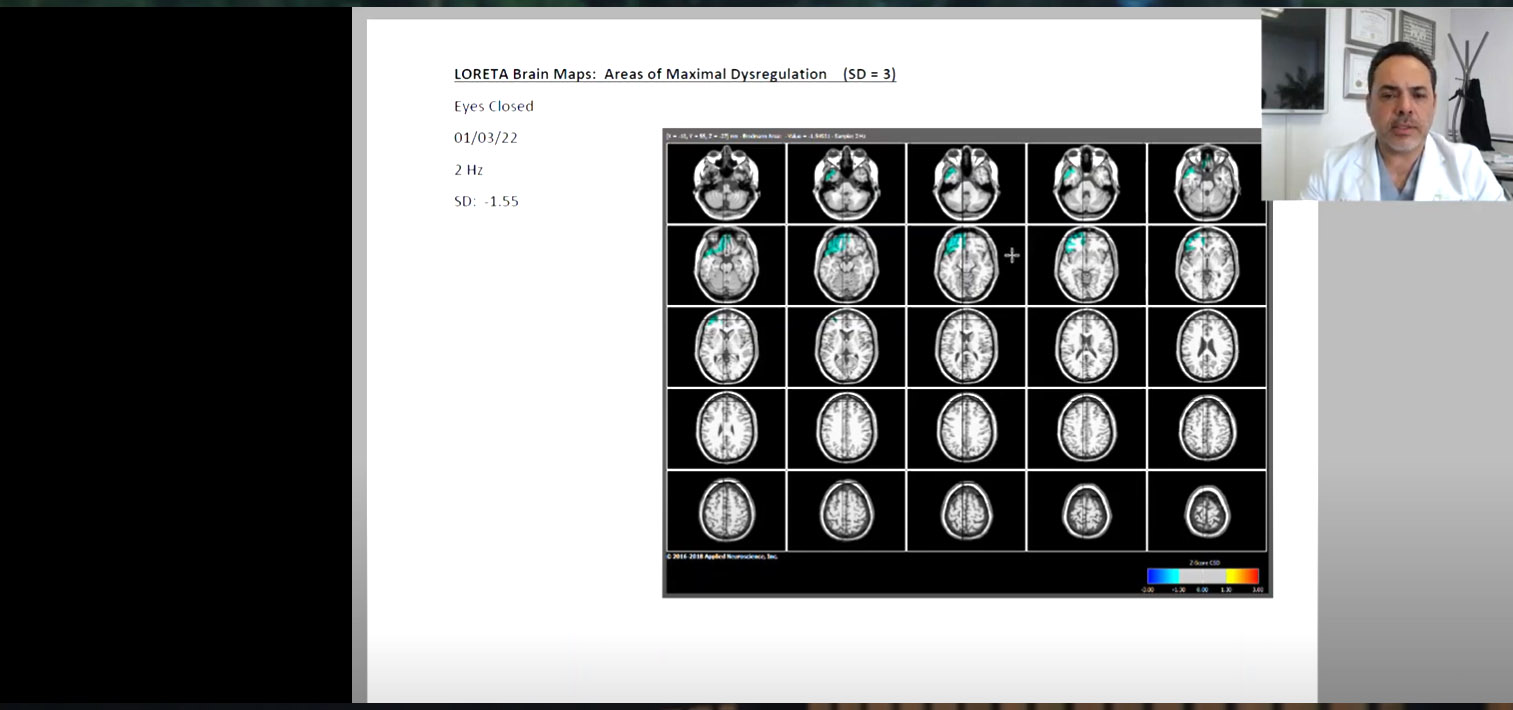 Before vs After: Cognitive, Sleep, and Emotional Success after Advanced Treatment–See the Data