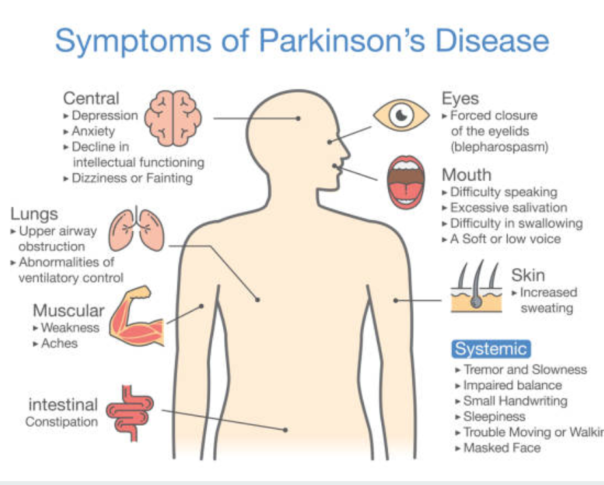 Symptoms of Parkinson’s Disease highlighting the importance of Parkinson’s Disease treatment in Orange County